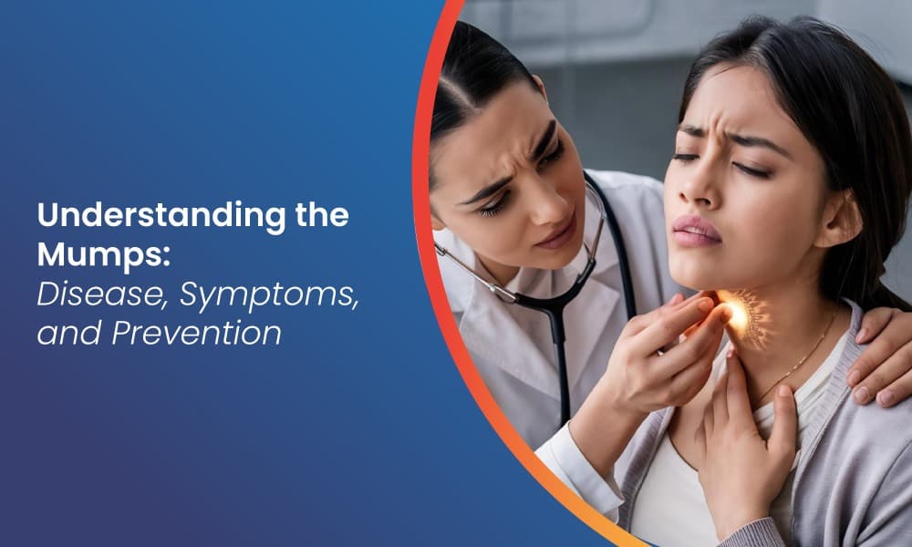 Mumps: Causes, Symptoms, Treatment, and Prevention