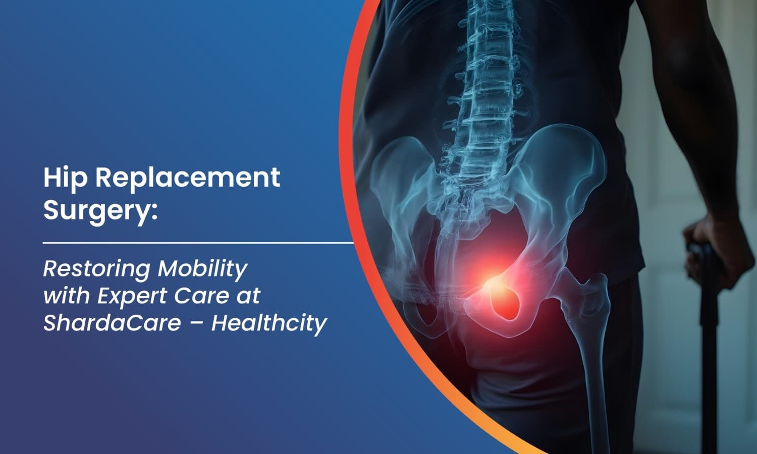 Hip Replacement Surgery: Restoring Mobility with Expert Care at ShardaCare-Healthcity