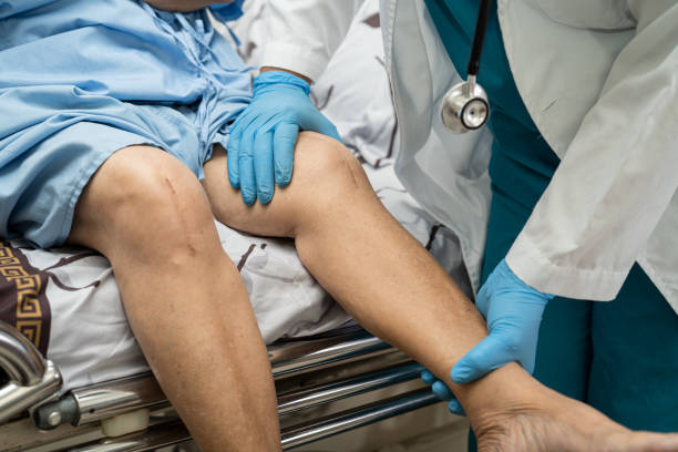 Total Knee Replacement Surgery