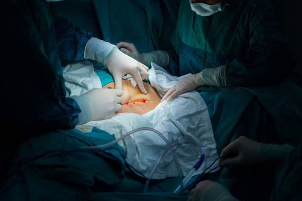 Reconstructive Urology