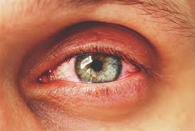 Vitreo-Retinal Disease